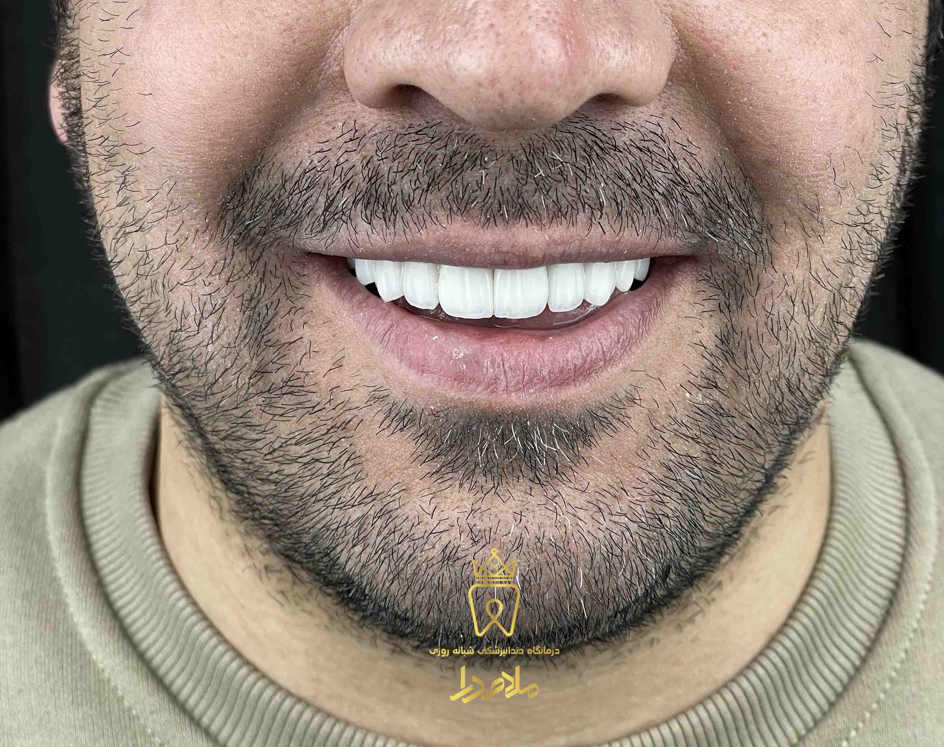 لمینیت
